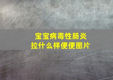 宝宝病毒性肠炎拉什么样便便图片