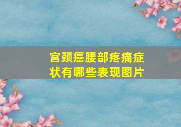 宫颈癌腰部疼痛症状有哪些表现图片