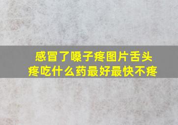 感冒了嗓子疼图片舌头疼吃什么药最好最快不疼