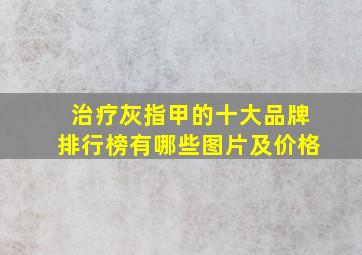 治疗灰指甲的十大品牌排行榜有哪些图片及价格