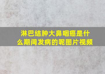 淋巴结肿大鼻咽癌是什么期间发病的呢图片视频