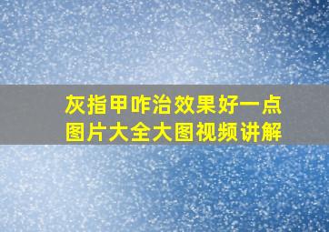 灰指甲咋治效果好一点图片大全大图视频讲解