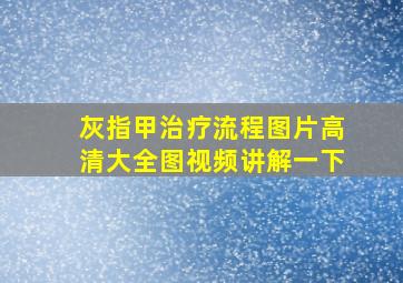 灰指甲治疗流程图片高清大全图视频讲解一下