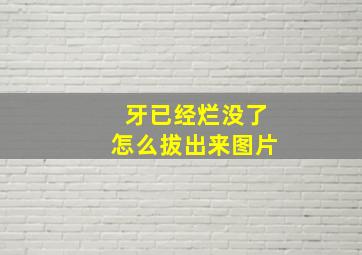 牙已经烂没了怎么拔出来图片