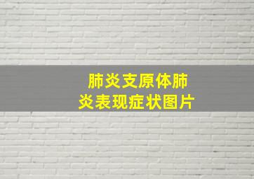 肺炎支原体肺炎表现症状图片