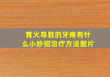 胃火导致的牙疼有什么小妙招治疗方法图片