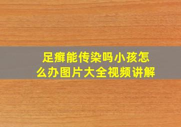 足癣能传染吗小孩怎么办图片大全视频讲解