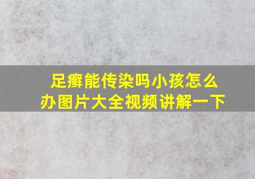 足癣能传染吗小孩怎么办图片大全视频讲解一下