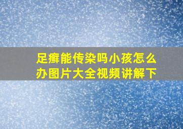 足癣能传染吗小孩怎么办图片大全视频讲解下