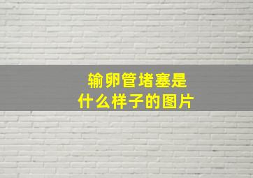 输卵管堵塞是什么样子的图片