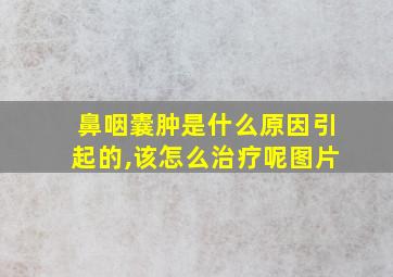 鼻咽囊肿是什么原因引起的,该怎么治疗呢图片