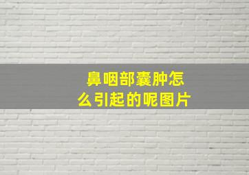 鼻咽部囊肿怎么引起的呢图片